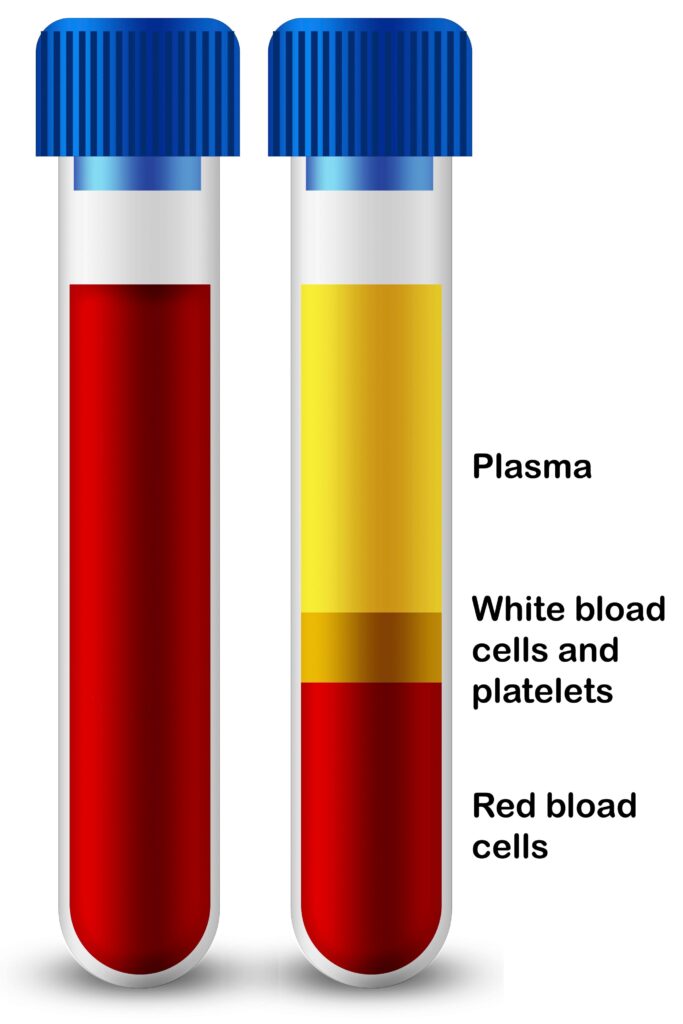 a picture of blood test